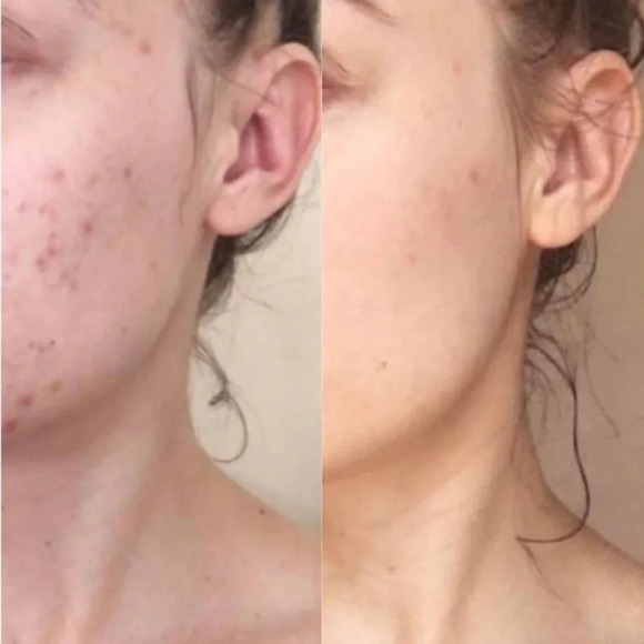 Three Ships Purify Aloe+Amino Acid Cleanser 0.5 oz - Picture 9 of 10